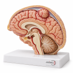 Meningioma Model